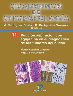 Punción aspiración con aguja fina en el diagnóstico de los tumores de hueso | 9788499694221 | González Cámpora, Ricardo;Galera Davidson, Hugo
