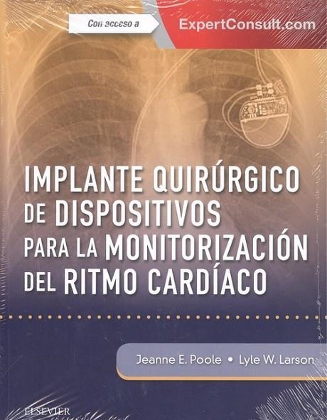 Implante quir£rgico de dispositivos para la monitorizaci¢n del ritmo card¡aco + ExpertConsult | 9788491133148 | Poole, Jeanne E.;Larson, Lyle W.