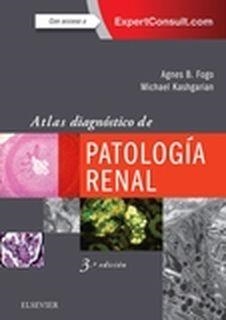 Atlas diagnóstico de patología renal + ExpertConsult (3ª ed.) | 9788491132936 | Fogo, Agnes B.;Kashgarian, M.
