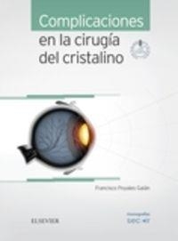 Complicaciones en la cirugía del cristalino + acceso web | 9788491130345 | Poyales Galán, Francisco;Garzón Jiménez, Nuria