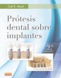 Prótesis dental sobre implantes (2ª ed.) | 9788490228630 | Misch, Carl E.