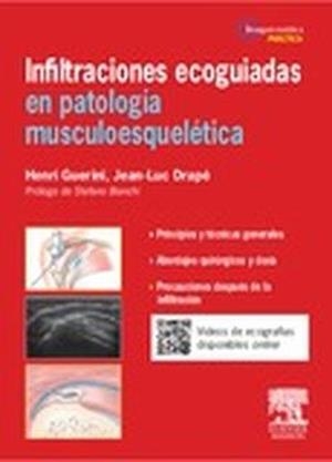 Infiltraciones ecoagudas en patología musculoesquelética | 9788445825297 | Guerini, Henri;Drapé, Jean-Luc