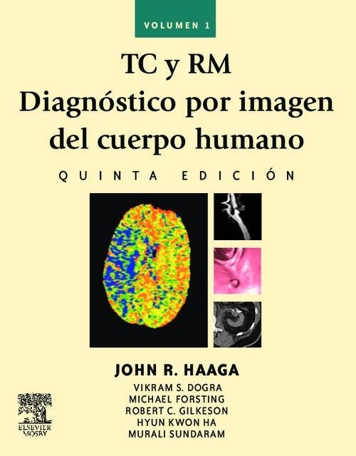 TC y RM. Diagnóstico por imagen del cuerpo humano | 9788480867245