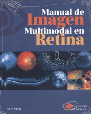 Manual de imagen multimodal en retina | 9788491133568 | de la mácula, Club Español