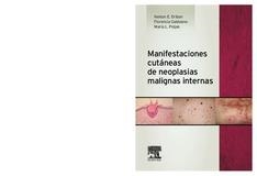 Manifestaciones cutáneas de neoplasias malignas internas | 9788490225288 | Driban, Nelson Edgardo;Galdeano De Acosta, Florencia;Poljak, María Luisa