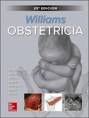 WILLIAMS OBSTETRICIA. | 9781456267360