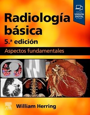 RADIOLOGÍA BÁSICA (5ª ED.) | 9788413825793 | HERRING, WILLIAM