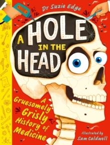 A HOLE IN THE HEAD | 9781444975338 | SUZIE EDGE