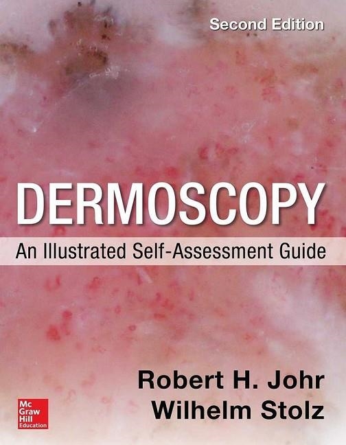 DERMOSCOPY: AN ILLUSTRATED SELF-ASSESSMENT GUIDE | 9780071834346