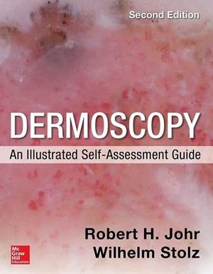 DERMOSCOPY: AN ILLUSTRATED SELF-ASSESSMENT GUIDE | 9780071834346