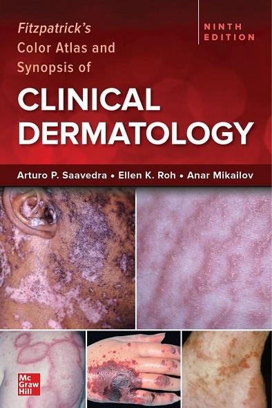FITZPATRICKS COLOR ATLAS AND SYNOPSIS OF CLINICAL DERMATOLO | 9781264278015