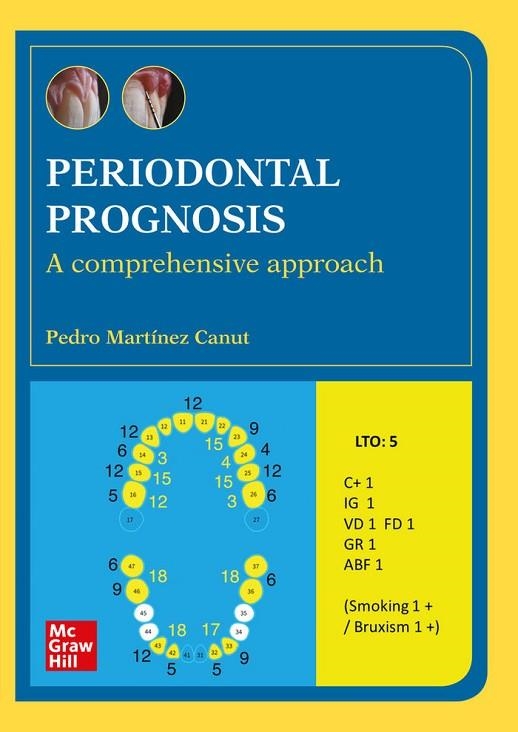 PERIODONTAL PROGNOSIS A COMPREHENSIVE APPROACH (POD) | 9788448617714