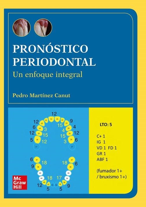 PRONOSTICO PERIODONTAL POD | 9788448620165